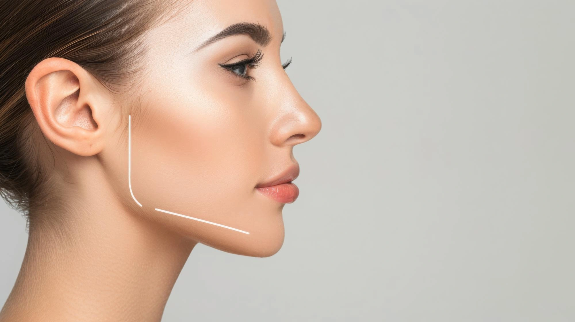 Side profile of woman with enhanced chin projection and balanced facial contour