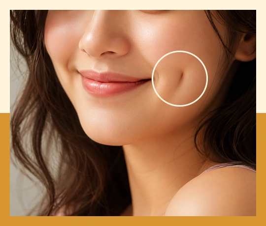 Close-up of smile highlighting cheek dimple for cosmetic dimple creation procedure.