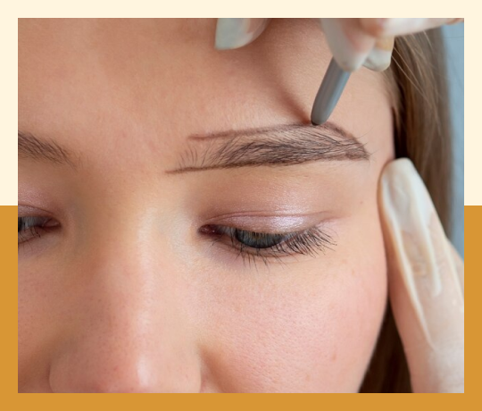 Eyebrow hair transplant